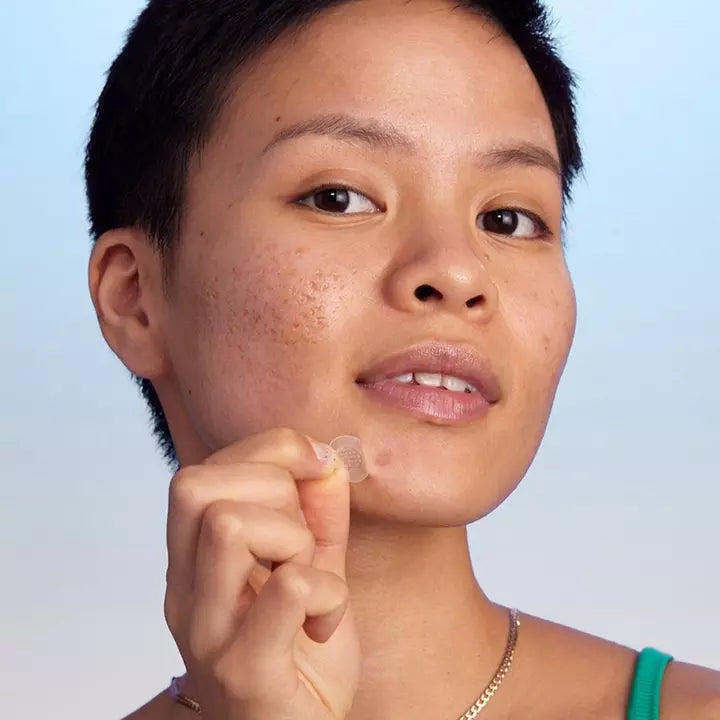 ZITSTICKA | KILLA KIT DEEP ZIT MICRODART PATCH 4-PACK