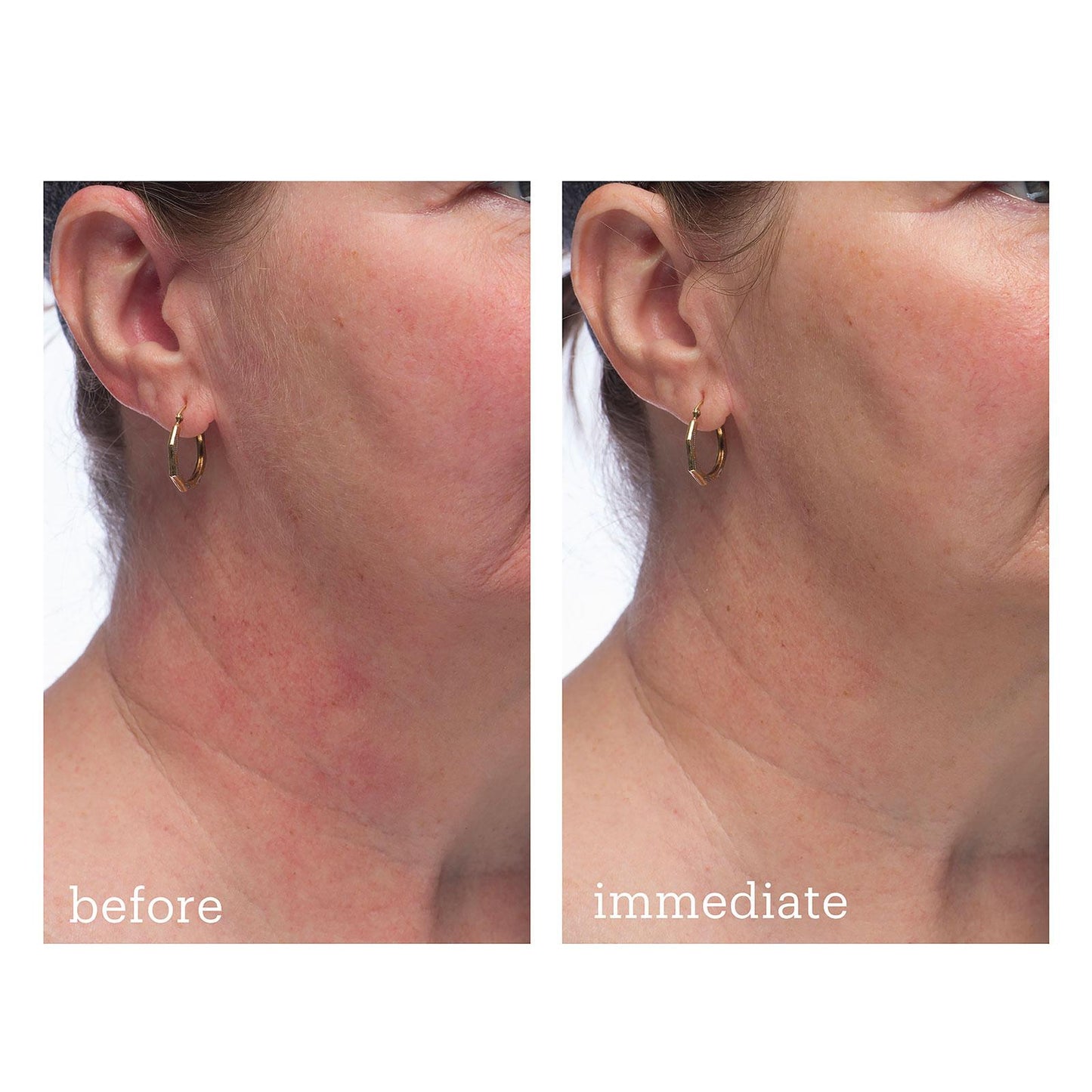 SKINFIX | BARRIER+ TRIPLE LIPID-PEPTIDE CREAM