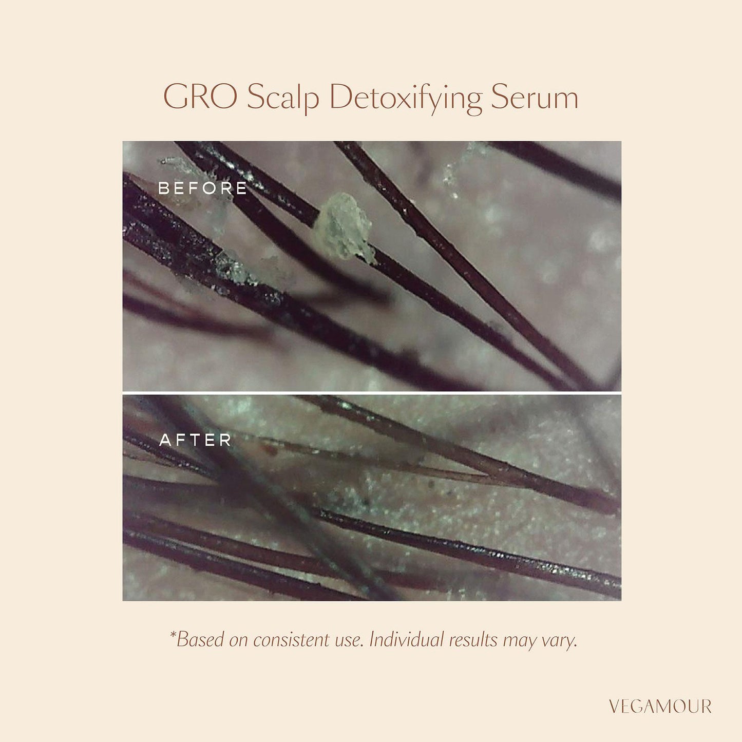 VEGAMOUR GRO | SCALP DETOXIFYING HAIR TREATMENT SERUM