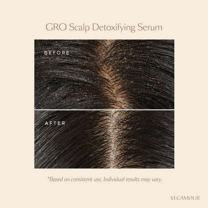 VEGAMOUR GRO | SCALP DETOXIFYING HAIR TREATMENT SERUM