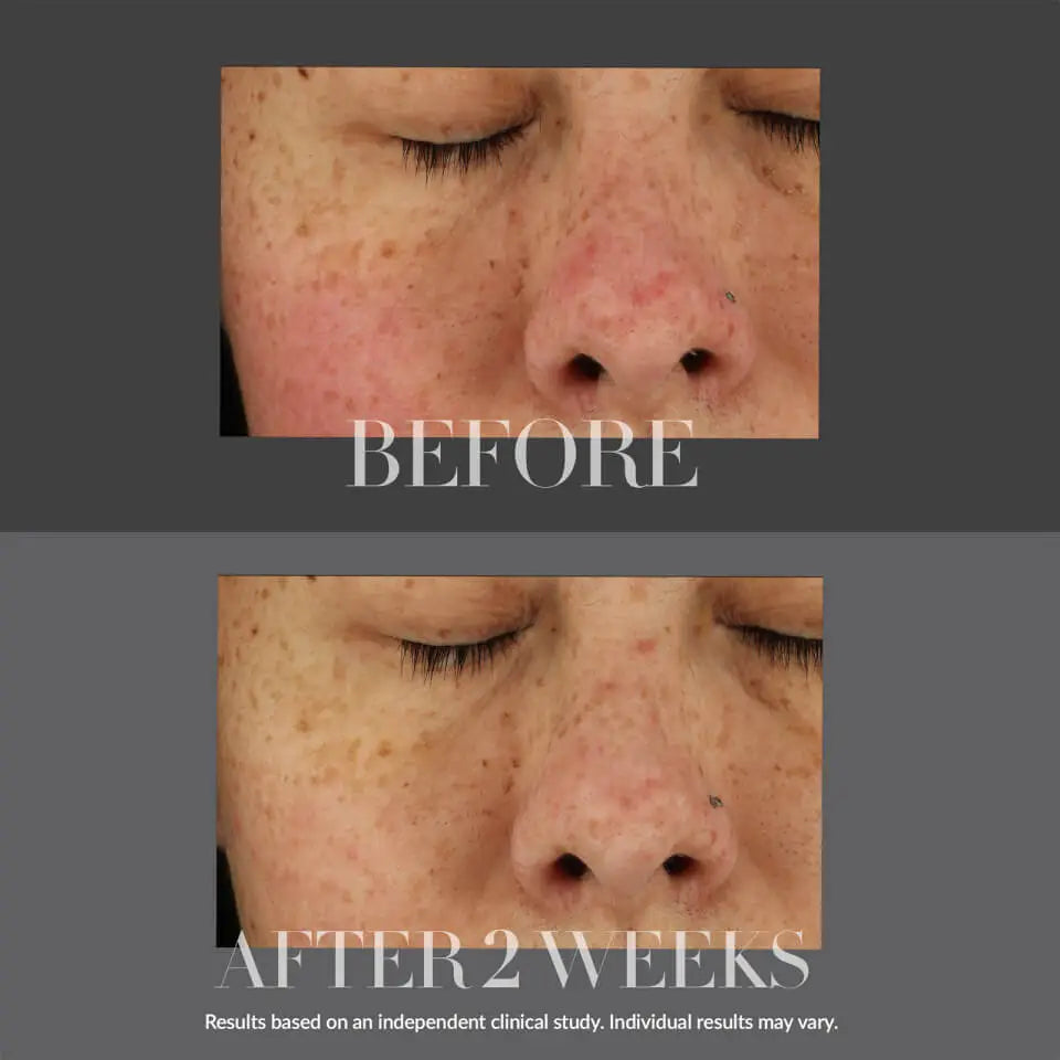 KATE SOMERVILLE | KATECEUTICALS TOTAL REPAIR CREAM