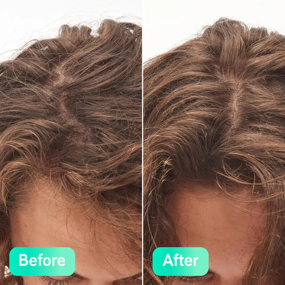 THE INKEY LIST | Glycolic Acid Exfoliating Scalp Scrub