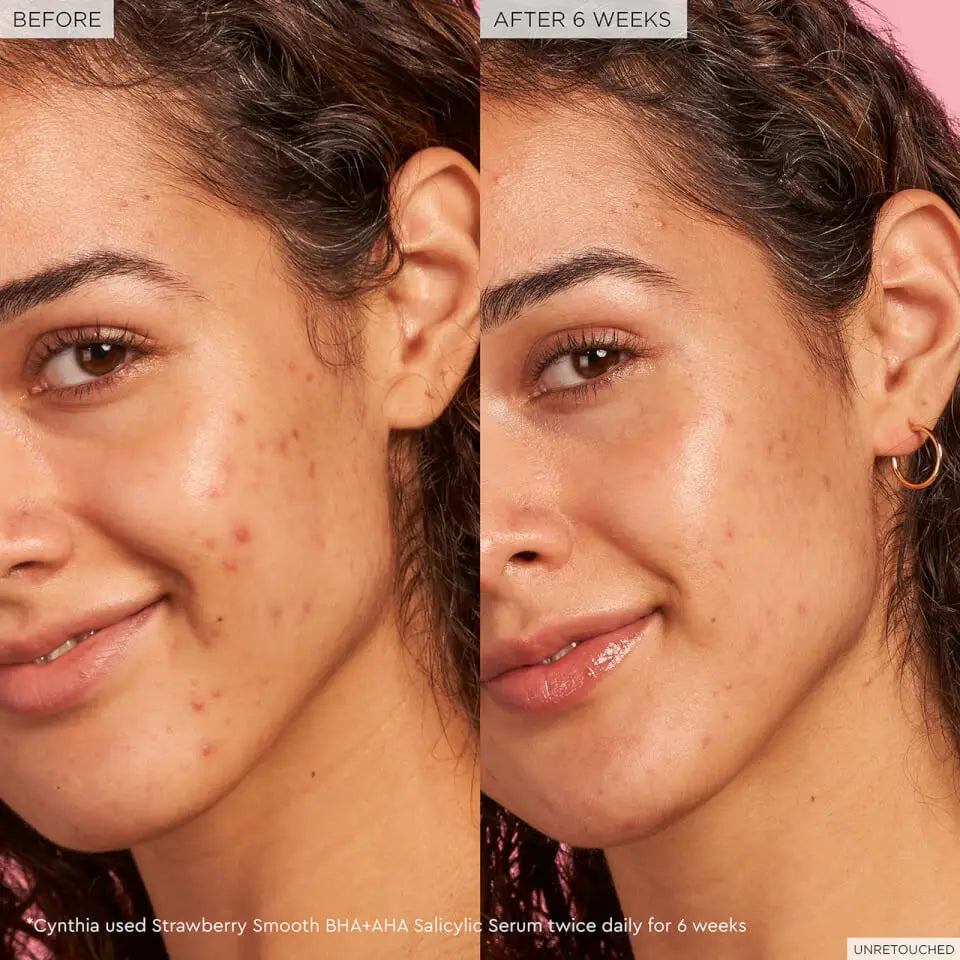 GLOW RECIPE | STRAWBERRY SMOOTH BHA+AHA SALICYLIC SERUM
