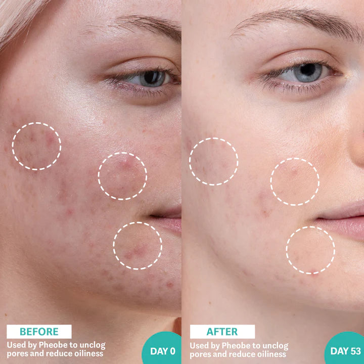 THE INKEY LIST | SALICYLIC ACID & SEA KELP PORE CLEARING AND OIL CONTROL SERUM