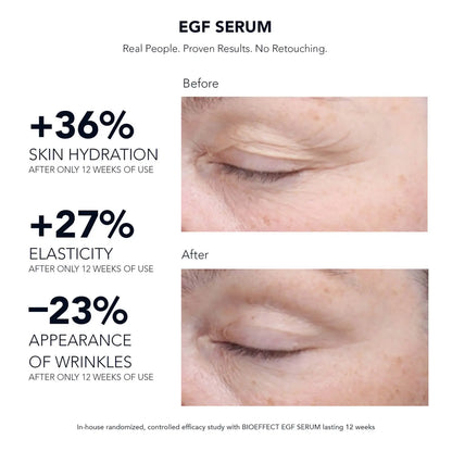 BIOEFFECT | EGF SERUM