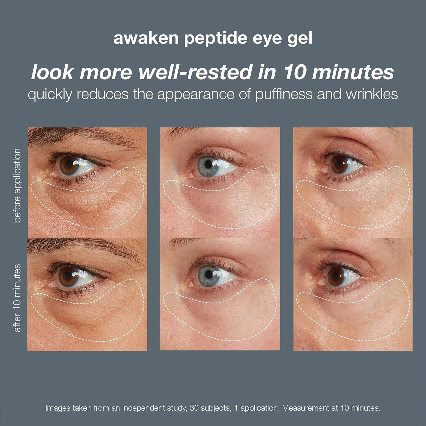 DERMALOGICA | AWAKEN PEPTIDE EYE GEL