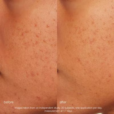 DERMALOGICA | DAILY MICROFOLIANT
