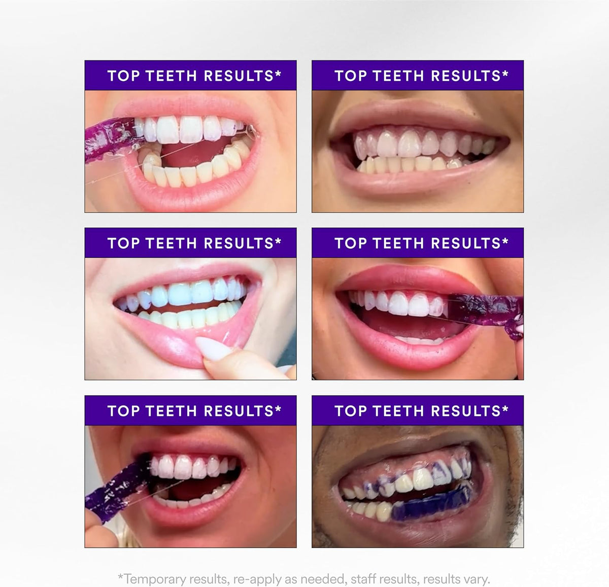 HISMILE | V34 WHITENING STRIPS