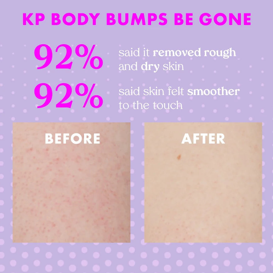 KOPARI BEAUTY | BODY BUMPS BE GONE