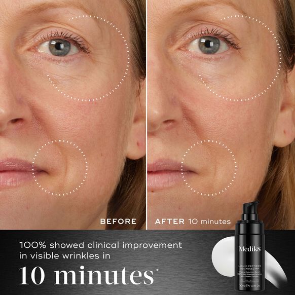 MEDIK8 | LIQUID PEPTIDES ADVANCED MP