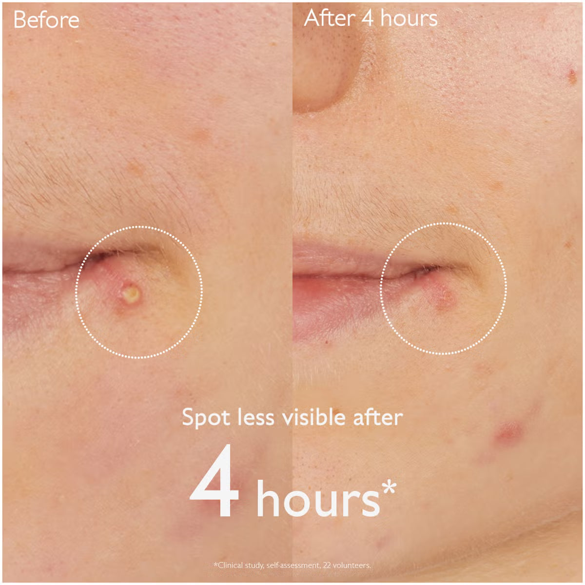 CAUDALIE | VINOPURE SALICYLIC SPOT SOLUTION