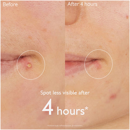 CAUDALIE | VINOPURE SALICYLIC SPOT SOLUTION