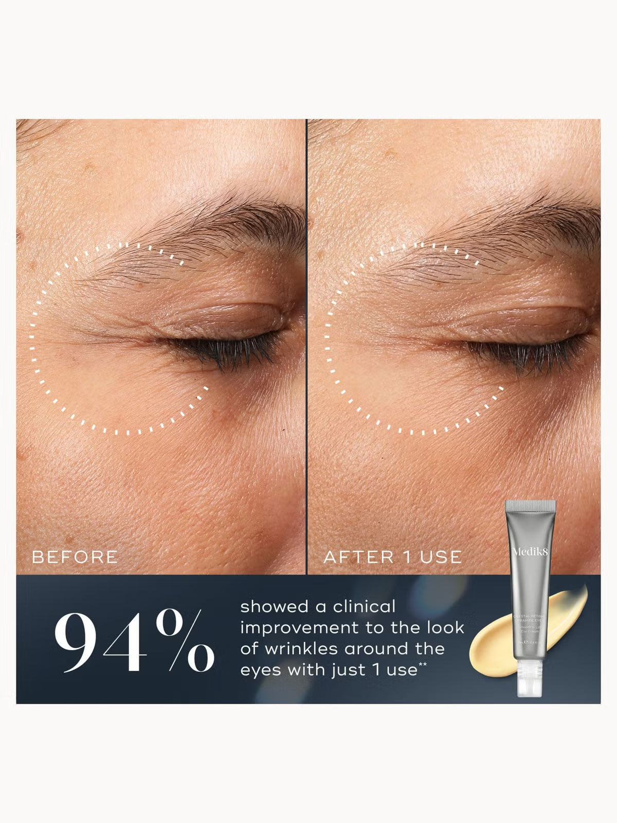 MEDIK8 | CRYSTAL RETINAL CERAMIDE EYE 6